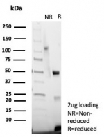 SDS-PAGE analysis of purified, BSA-free vWF antibody (clone VWF/7979R) as confirmation of integrity and purity.