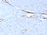 IHC staining of FFPE human uterus tissue with vWF antibody (clone VWF/7979R). HIER: boil tissue sections in pH 9 10mM Tris with 1mM EDTA for 20 min and allow to cool before testing.