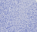 Negative control: IHC testing of FFPE human brain tissue with recombinant CD4 antibody (clone CD4/8203R) at 2ug/ml. HIER: boil tissue sections in pH 9 10mM Tris with 1mM EDTA for 20 min and allow to cool before testing.