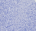 Negative control: IHC testing of FFPE human brain tissue with recombinant CD4 antibody (clone CD4/8203R) at 2ug/ml. HIER: boil tissue sections in pH 9 10mM Tris with 1mM EDTA for 20 min and allow to cool before testing.