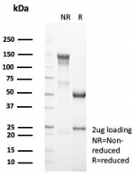 SDS-PAGE analysis of purified, BSA-free recombinant CD4 antibody (clone CD4/8203R) as confirmation of integrity and purity.