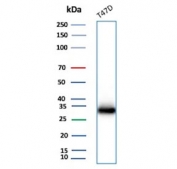 Western blot testing of human T-47D cell lysate with FGF23 antibody. Predicted molecular weight: 28-32 kDa.