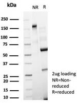 SDS-PAGE analysis of purified, BSA-free CD63 antibody (clone LAMP3/8248R) as confirmation of integrity and purity.