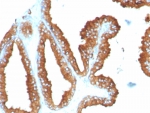 IHC staining of FFPE human prostate tissue with CD63 antibody (clone LAMP3/8248R). HIER: boil tissue sections in pH 9 10mM Tris with 1mM EDTA for 20 min and allow to cool before testing.