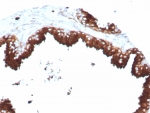 IHC staining of FFPE human prostate tissue with CD63 antibody (clone LAMP3/8770R). HIER: boil tissue sections in pH 9 10mM Tris with 1mM EDTA for 20 min and allow to cool before testing.