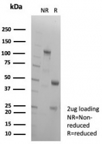 SDS-PAGE analysis of purified, BSA-free Collagen II antibody (clone COL2A1/8810R) as confirmation of integrity and purity.
