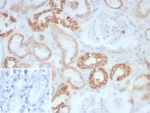 IHC staining of FFPE human kidney tissue with COL2A1 antibody (clone COL2A1/8882R). Inset: PBS used in place of primary Ab (secondary Ab negative control). HIER: boil tissue sections in pH 9 10mM Tris with 1mM EDTA for 20 min and allow to cool before testing.