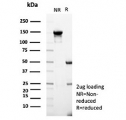 SDS-PAGE analysis of purified, BSA-free Cytokeratin-7 antibody (clone KRT7/3733) as confirmation of integrity and purity.