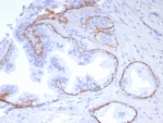 IHC staining of FFPE human prostate tissue with recombinant KRT5 antibody (clone rKRT5/6969). HIER: boil tissue sections in pH 9 10mM Tris with 1mM EDTA for 20 min and allow to cool before testing.