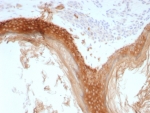 IHC staining of FFPE human skin tissue with recombinant Basic Cytokeratin antibody (clone rKRTH/8883). HIER: boil tissue sections in pH 9 10mM Tris with 1mM EDTA for 20 min and allow to cool before testing.