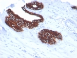 IHC staining of FFPE human prostate tissue with Keratin 18 antibody (clone KRT18/7056R). HIER: boil tissue sections in pH 9 10mM Tris with 1mM EDTA for 20 min and allow to cool before testing.
