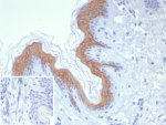 IHC staining of FFPE human skin tissue with Cytokeratin 1 antibody (clone KRT1/8342R). Inset: PBS used in place of primary Ab (secondary Ab negative control). HIER: boil tissue sections in pH 9 10mM Tris with 1mM EDTA for 20 min and allow to cool before testing.