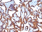 IHC staining of FFPE human placental tissue with Cytokeratin 7 antibody (clone KRT7/8121R). HIER: boil tissue sections in pH 9 10mM Tris with 1mM EDTA for 20 min and allow to cool before testing.