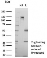SDS-PAGE analysis of purified, BSA-free KRT6 antibody (clone KRT6/8267R) as confirmation of integrity and purity.