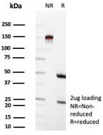 SDS-PAGE analysis of purified, BSA-free CD63 antibody (clone rLAMP3/8604) as confirmation of integrity and purity.