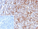 IHC staining of FFPE human tonsil tissue with CD63 antibody (clone rLAMP3/8604). Inset: PBS used in place of primary Ab (secondary Ab negative control). HIER: boil tissue sections in pH 9 10mM Tris with 1mM EDTA for 20 min and allow to cool before testing.