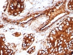 IHC staining of FFPE human prostate tissue with CD63 antibody (clone LAMP3/8705R). HIER: boil tissue sections in pH 9 10mM Tris with 1mM EDTA for 20 min and allow to cool before testing.