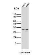 CDK4 Antibody HeLa and MCF7 WB. Western blot analysis of Cyclin-dependent kinase 4 (CDK4) expression in cell lysates using CDK4 antibody clone CDK4/8351R. Lane 1: HeLa cell lysate, Lane 2: MCF7 cell lysate. A band is detected at approximately 33â34 kDa, consistent with the predicted molecular weight of CDK4, a key regulator of G1 to S phase cell cycle progression. Signal is observed in both cell lines, aligning with the known expression of CDK4 in proliferating cells.