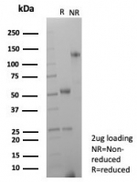 SDS-PAGE analysis of purified, BSA-free recombinant CD63 antibody (clone LAMP3/8799R) as confirmation of integrity and purity.