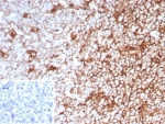 IHC staining of FFPE human tonsil tissue with recombinant CD63 antibody (clone LAMP3/8799R). Inset: PBS used in place of primary Ab (secondary Ab negative control). HIER: boil tissue sections in pH 9 10mM Tris with 1mM EDTA for 20 min and allow to cool before testing.