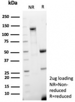 SDS-PAGE analysis of purified, BSA-free recombinant LAMP-3 antibody (clone LAMP3/8678R) as confirmation of integrity and purity.
