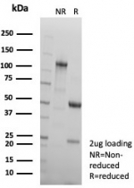 SDS-PAGE analysis of purified, BSA-free CD91 / LRP1 antibody (clone LRP1/7152) as confirmation of integrity and purity.