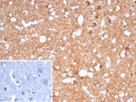 IHC staining of FFPE human brain tissue with CD91 / LRP1 antibody (clone LRP1/7152) Inset: PBS used in place of primary Ab (secondary Ab negative control). HIER: boil tissue sections in pH 9 10mM Tris with 1mM EDTA for 20 min and allow to cool before testing.