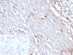 IHC staining of FFPE human cerebellum tissue with STAT6 antibody (clone STAT6/7774R). Inset: PBS used in place of primary Ab (secondary Ab negative control). HIER: boil tissue sections in pH 9 10mM Tris with 1mM EDTA for 20 min and allow to cool before testing.