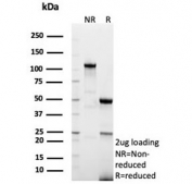 SDS-PAGE analysis of purified, BSA-free recombinant A2MR antibody (clone LRP1/8771R) as confirmation of integrity and purity.