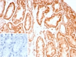 IHC staining of FFPE human kidney tissue with recombinant CD91 antibody (clone LRP1/8947R) Inset: PBS used in place of primary Ab (secondary Ab negative control). HIER: boil tissue sections in pH 9 10mM Tris with 1mM EDTA for 20 min and allow to cool before testing.