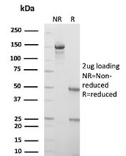 SDS-PAGE analysis of purified, BSA-free CDK4 antibody (CDK4/8210R) as confirmation of integrity and purity.