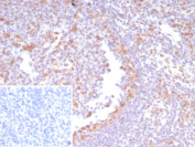 CDK4 Antibody Human Tonsil Tissue IHC. Immunohistochemistry staining of FFPE human tonsil tissue with CDK4 antibody (clone CDK4/8210R). Inset: PBS used in place of primary Ab (secondary Ab negative control). HIER: boil tissue sections in pH 9 10mM Tris with 1mM EDTA for 20 min and allow to cool before testing.