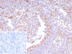 IHC staining of FFPE human tonsil tissue with CDK4 antibody (clone CDK4/8210R). Inset: PBS used in place of primary Ab (secondary Ab negative control). HIER: boil tissue sections in pH 9 10mM Tris with 1mM EDTA for 20 min and allow to cool before testing.