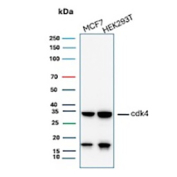 CDK4 Antibody Cell Line WB. Western blot analysis of Cyclin-dependent kinase 4 (CDK4) expression in cell lysates using CDK4 antibody. Lane 1: MCF7 cell lysate, Lane 2: HEK293T cell lysate. A band is detected at approximately 33â34 kDa, consistent with the predicted molecular weight of CDK4, a key regulator of G1 to S phase cell cycle progression. A lower-molecular-weight band is also observed at approximately 15â20 kDa, which may represent proteolytic processing or non-specific reactivity. The presence of CDK4 signal in both cell lines aligns with its known expression in proliferating cells.