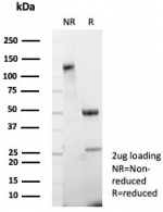 SDS-PAGE analysis of purified, BSA-free MDM2 antibody (clone MDM2/7942) as confirmation of integrity and purity.