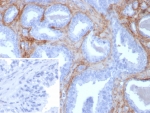 IHC staining of FFPE human prostate tissue with recombinant POSTN antibody (clone rPOSTN/8522). Inset: PBS used in place of primary Ab (secondary Ab negative control). HIER: boil tissue sections in pH 9 10mM Tris with 1mM EDTA for 20 min and allow to cool before testing.
