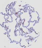 IHC staining of FFPE human lung tissue with CD162 antibody (clone PSGL1/8135R). HIER: boil tissue sections in pH 9 10mM Tris with 1mM EDTA for 20 min and allow to cool before testing.