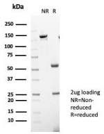 SDS-PAGE analysis of purified, BSA-free Interleukin-31 antibody (clone IL31/7333) as confirmation of integrity and purity.