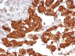 IHC staining of FFPE human adrenal gland tissue with Interleukin-31 antibody (clone IL31/7333). HIER: boil tissue sections in pH 9 10mM Tris with 1mM EDTA for 20 min and allow to cool before testing.