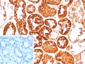 IHC staining of FFPE human kidney tissue with Coagulation Factor VII antibody (clone F7/4931). Inset: PBS used in place of primary Ab (secondary Ab negative control). HIER: boil tissue sections in pH 9 10mM Tris with 1mM EDTA for 20 min and allow to cool before testing.