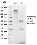 SDS-PAGE analysis of purified, BSA-free Coagulation Factor VII antibody (clone F7/3512) as confirmation of integrity and purity.