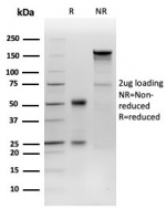 SDS-PAGE analysis of purified, BSA-free F7 antibody (clone F7/3515) as confirmation of integrity and purity.