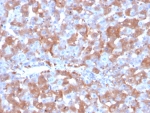 IHC staining of FFPE human liver tissue with F7 antibody (clone F7/3515). HIER: boil tissue sections in pH 9 10mM Tris with 1mM EDTA for 20 min and allow to cool before testing.