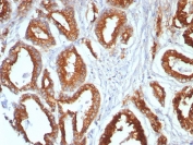 IHC staining of FFPE human prostate tissue with CD107a antibody (clone LAMP1/7456). HIER: boil tissue sections in pH 9 10mM Tris with 1mM EDTA for 20 min and allow to cool before testing.