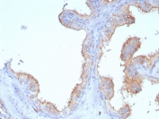 IHC staining of FFPE human prostate tissue with CD107a antibody (clone LAMP1/7457). HIER: boil tissue sections in pH 9 10mM Tris with 1mM EDTA for 20 min and allow to cool before testing.