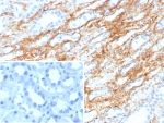 IHC staining of FFPE human kidney tissue with Collagen IV antibody (clone COL4/8657R). Inset: PBS used in place of primary Ab (secondary Ab negative control). HIER: boil tissue sections in pH 9 10mM Tris with 1mM EDTA for 20 min and allow to cool before testing.
