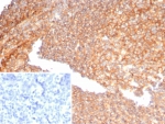 IHC staining of FFPE human tonsil tissue with AAT antibody (clone AAT/4486). Inset: PBS used in place of primary Ab (secondary Ab negative control). HIER: boil tissue sections in pH 9 10mM Tris with 1mM EDTA for 20 min and allow to cool before testing.