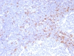 IHC staining of FFPE human tonsil tissue with recombinant IgD Heavy Chain antibody (clone IGHD/8228R). HIER: boil tissue sections in pH 9 10mM Tris with 1mM EDTA for 20 min and allow to cool before testing.