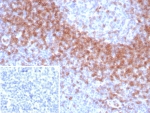 IHC staining of FFPE human tonsil tissue with IgD antibody (clone IGHD/8367R). Inset: PBS used in place of primary Ab (secondary Ab negative control). HIER: boil tissue sections in pH 9 10mM Tris with 1mM EDTA for 20 min and allow to cool before testing.