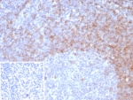 IHC staining of FFPE human tonsil tissue with IgD antibody (clone IGHD/8326R). Inset: PBS used in place of primary Ab (secondary Ab negative control). HIER: boil tissue sections in pH 9 10mM Tris with 1mM EDTA for 20 min and allow to cool before testing.
